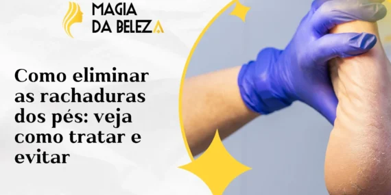 Como eliminar as rachaduras dos pés: veja como tratar e evitar