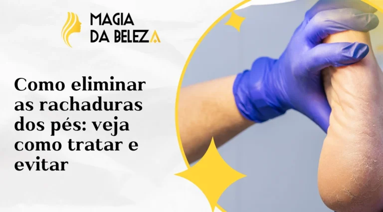 Como eliminar as rachaduras dos pés: veja como tratar e evitar