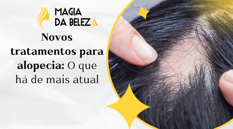 Novos tratamentos para alopecia: O que há de mais atual
