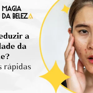 Como reduzir a oleosidade da pele? Soluções rápidas