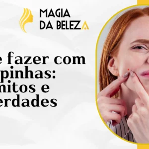 O que fazer com espinhas: mitos e verdades