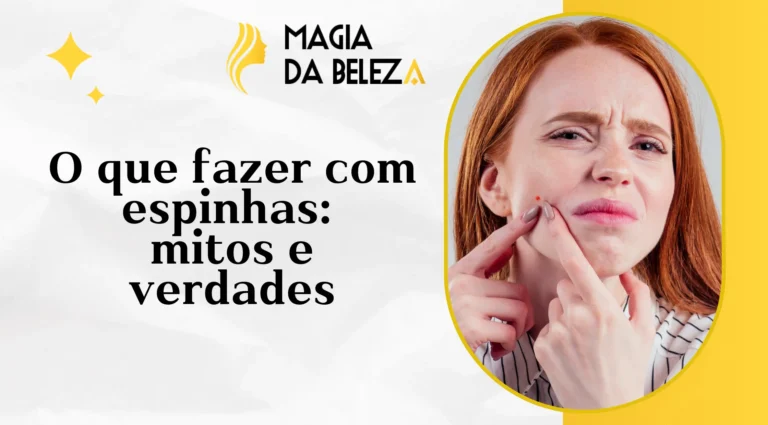 O que fazer com espinhas: mitos e verdades