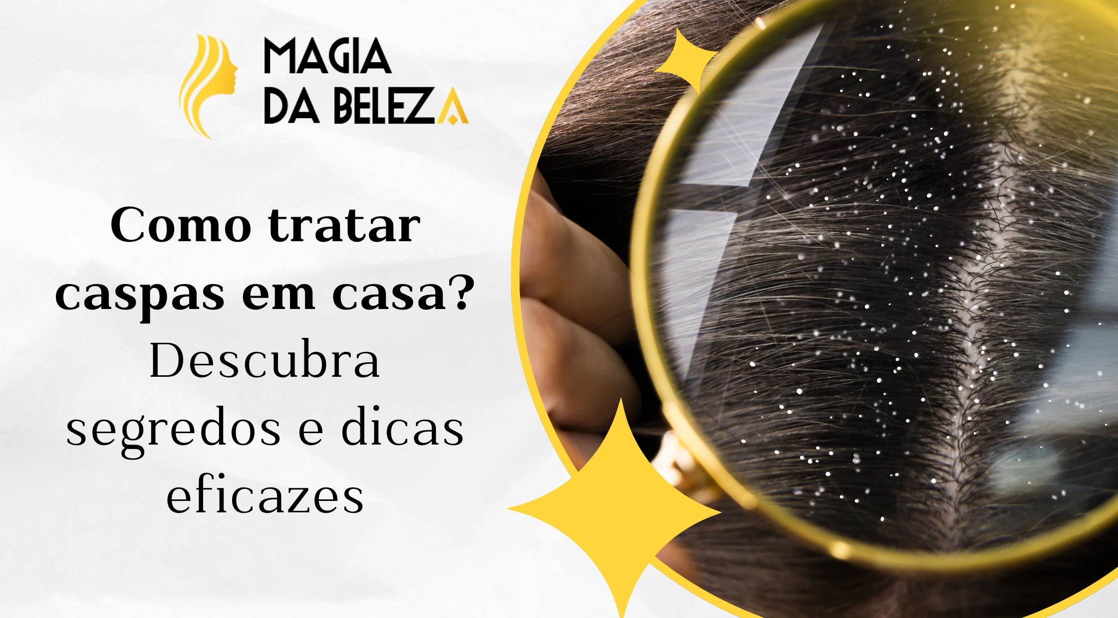 como tratar caspas em casa