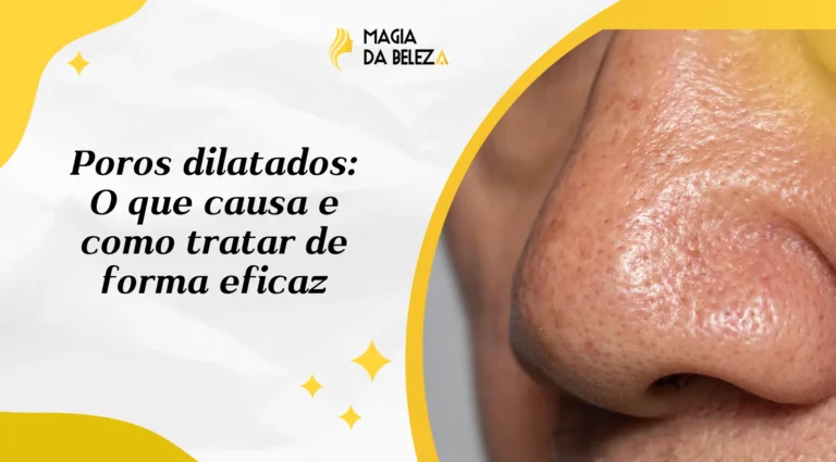 Poros dilatados: O que causa e como tratar de forma eficaz
