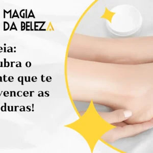 Ureia: descubra o ingrediente que te ajuda a vencer as rachaduras!