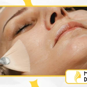 5 Erros Comuns de Skincare que Podem Estragar Sua Pele