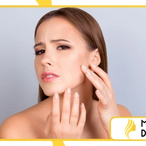 Pele oleosa no verão: produtos e ativos indispensáveis