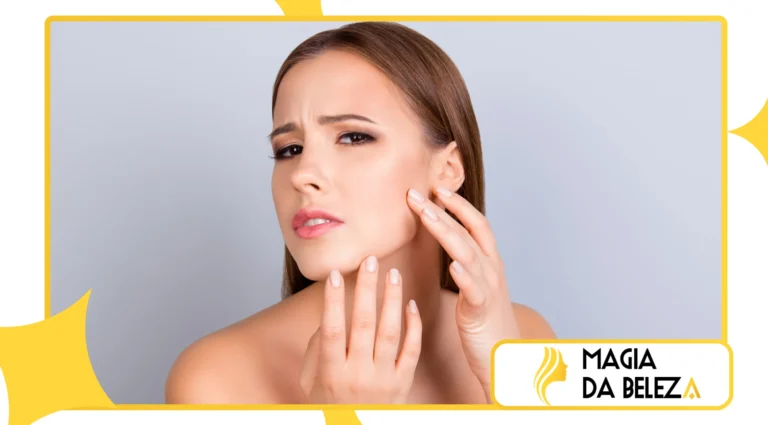 Pele oleosa no verão: produtos e ativos indispensáveis
