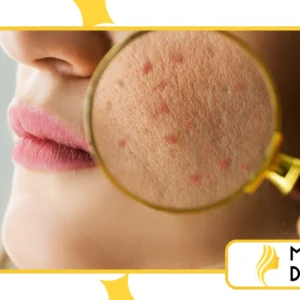 Microbioma da pele: o que é e qual a sua importância