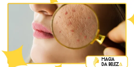 Microbioma da pele: o que é e qual a sua importância