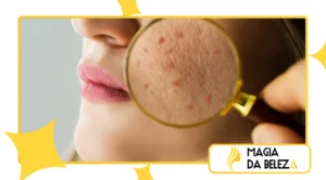 Pele feminina e menopausa precoce