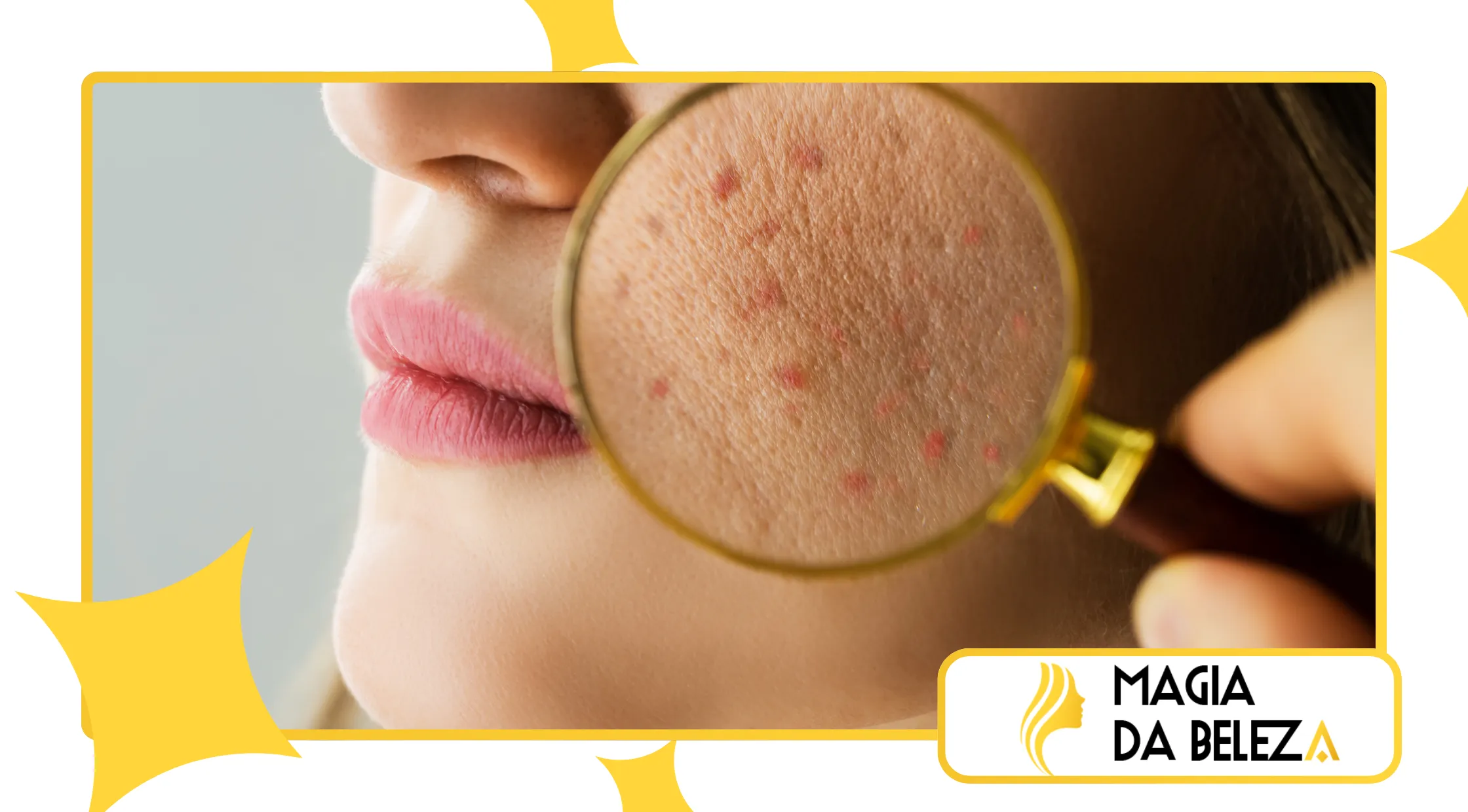 Pele feminina e menopausa precoce