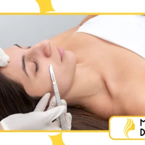 Dermaplaning no final de ano: vale a pena fazer antes do Natal e do réveillon?