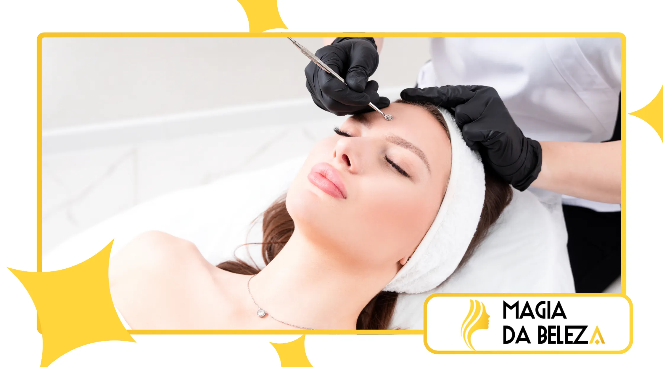 Dermaplaning no final de ano