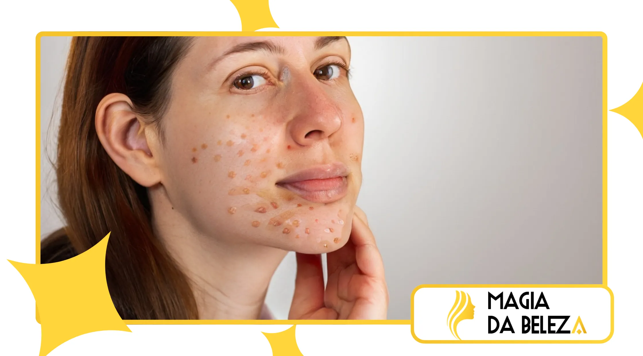 identificar se sua pele está inflamada