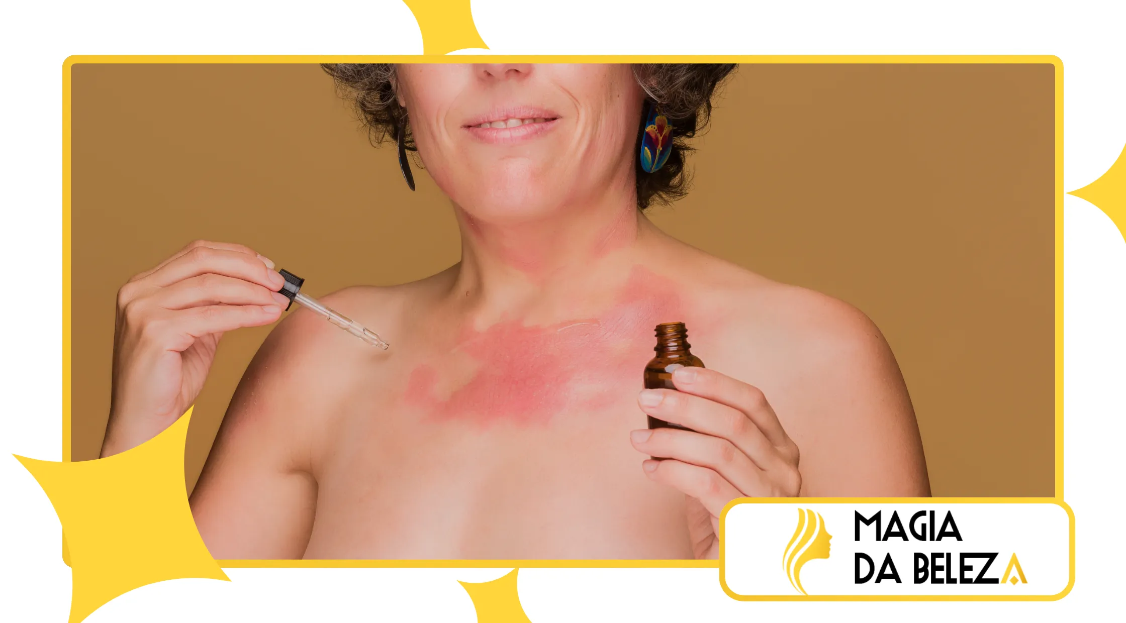 identificar se sua pele está inflamada