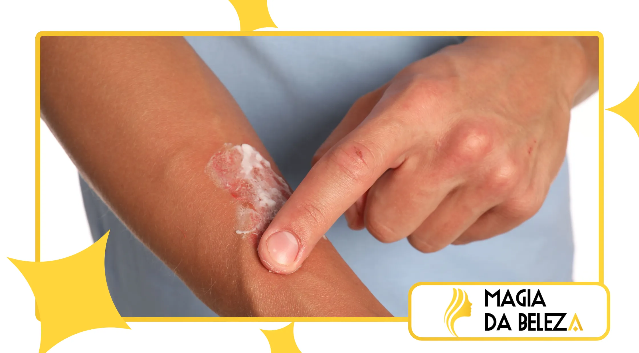 Tecnologias de diagnóstico de pele