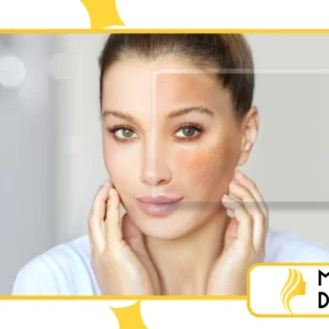 O que é skin barrier repair e por que virou prioridade global