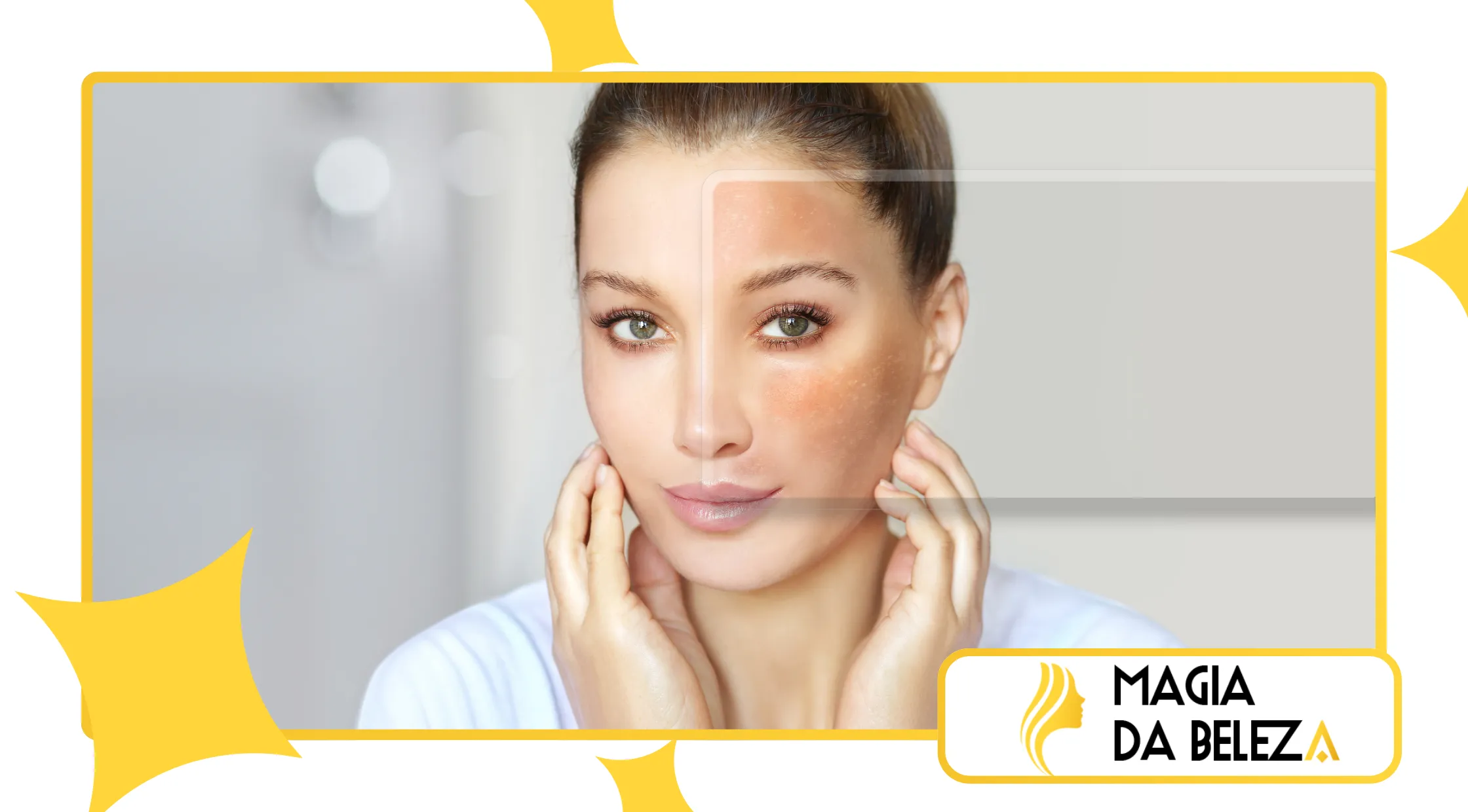 O que é skin barrier repair